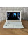 Ігровий ноутбук Acer Predator Helios 300 PH315-51 White / 15.6" (1920x1080) IPS / Intel Core i7-8750H (6 (12) ядер по 2.2 - 4.1 GHz) / 16 GB DDR4 / 256 GB SSD / nVidia GeForce GTX 1060, 6 GB GDDR5, 192-bit / WebCam б/в